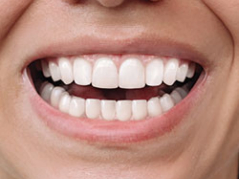 Complex Overcrowding Case Study at 32 Intact