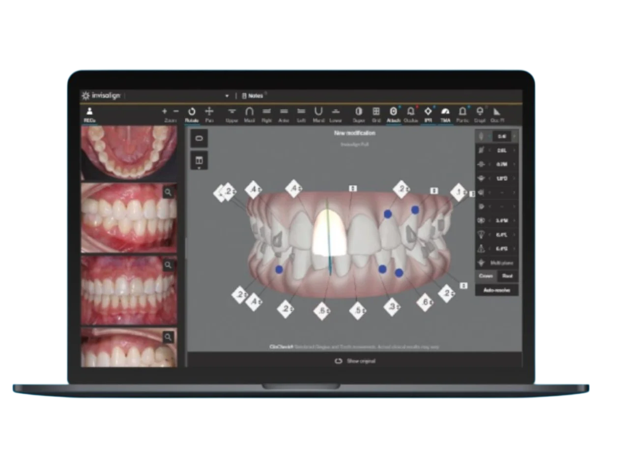 ClinCheck Technology