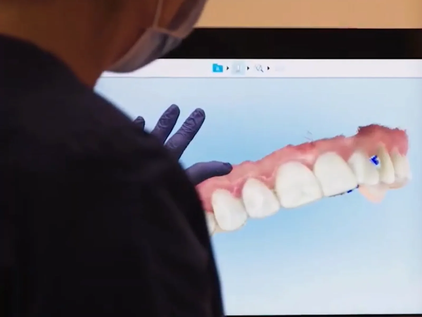 Invisalign Outcome Simulator