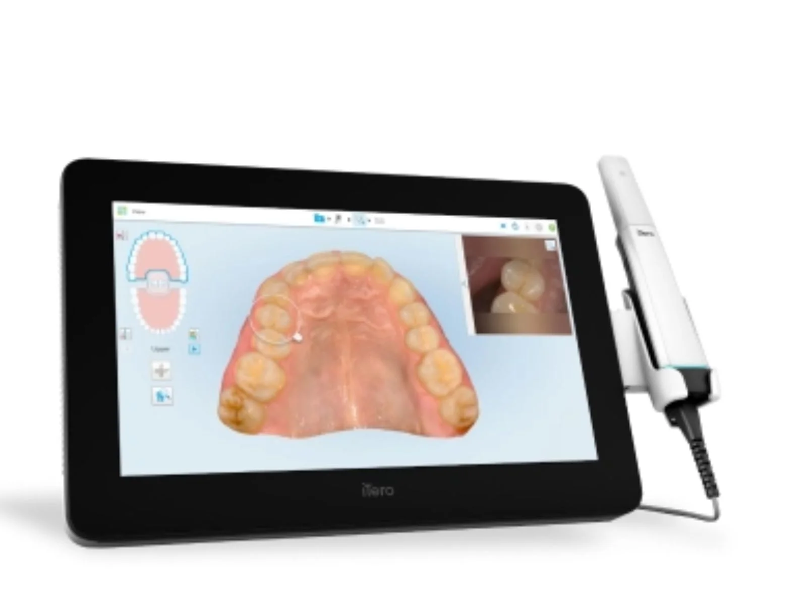 Digital Scan - 32 Intact